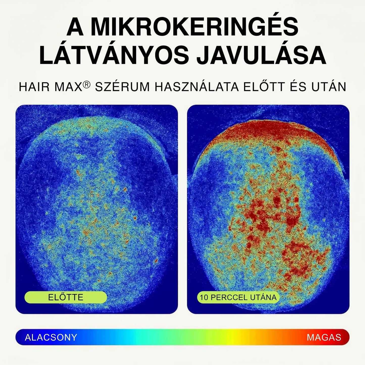 Hair Max® – Aktiváló hajszérum a hajnövekedés támogatására