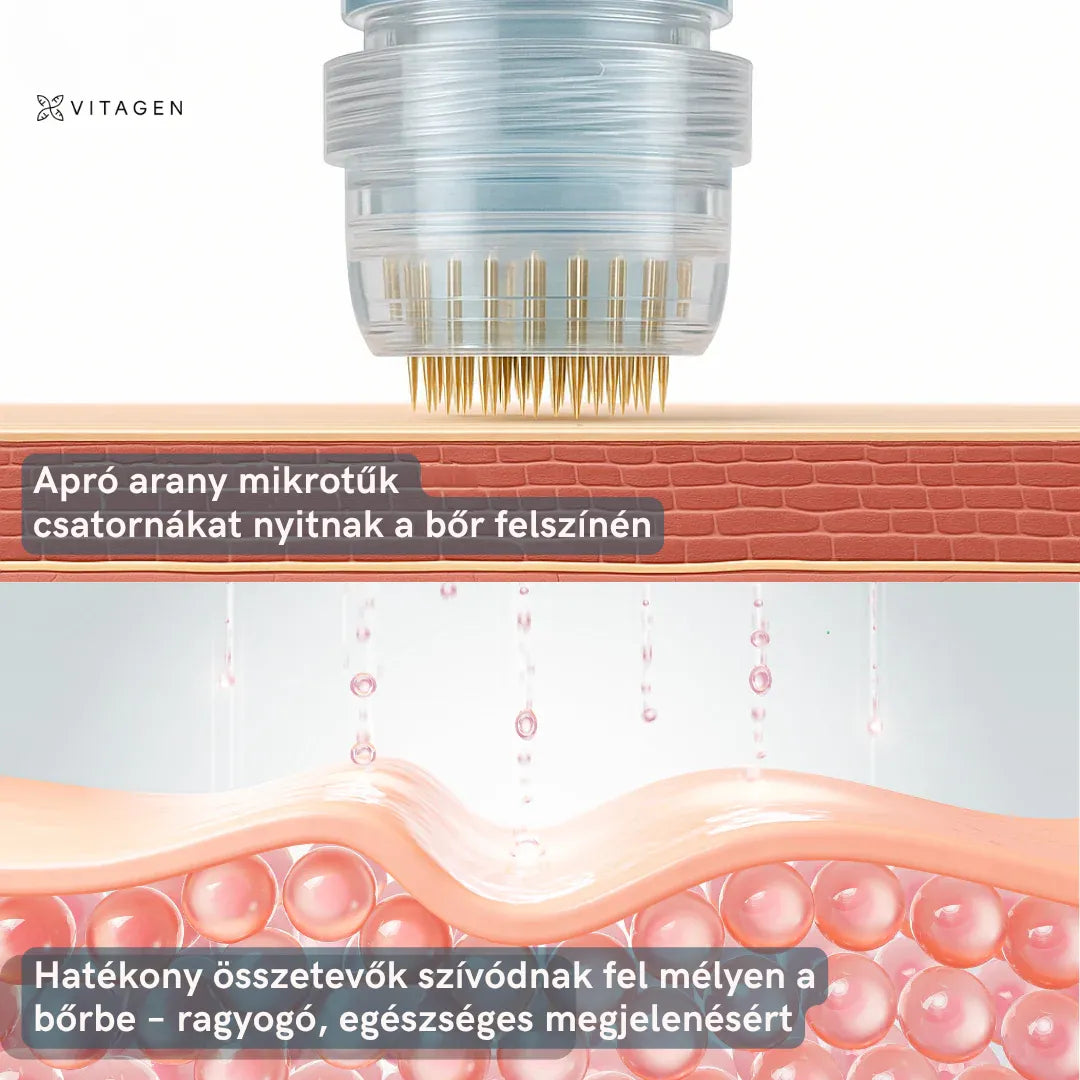 Vitagen Mikroinfúzió Kollagén Ajándékkal