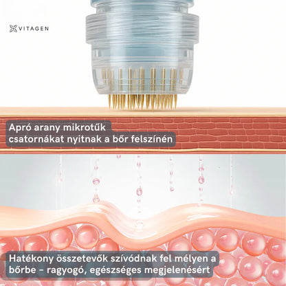 Vitagen Mikroinfúzió Kollagén Ajándékkal